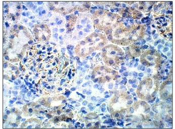 Anti-Bestrophin 3 antibody used in IHC (Paraffin sections) (IHC-P). GTX47910