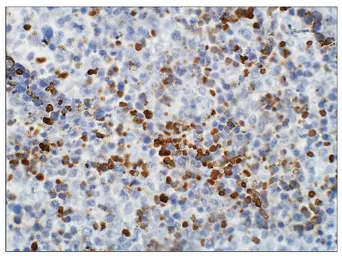 Anti-Aquarius antibody used in IHC (Paraffin sections) (IHC-P). GTX47914