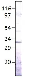Anti-Aquaporin 9 antibody used in Western Blot (WB). GTX47916
