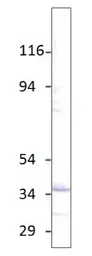 Anti-Aquaporin 6 antibody used in Western Blot (WB). GTX47918