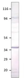 Anti-Aquaporin 12 antibody used in Western Blot (WB). GTX47925