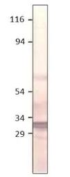 Anti-Aquaporin 11 antibody used in Western Blot (WB). GTX47927