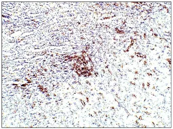 Anti-Aquaporin 10 antibody used in IHC (Paraffin sections) (IHC-P). GTX47929