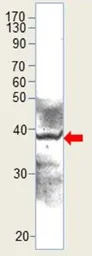 Anti-Aquaporin 10 antibody used in Western Blot (WB). GTX47929