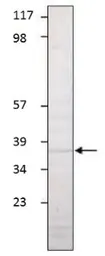Anti-Aquaporin 1 antibody used in Western Blot (WB). GTX47931