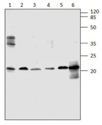 Anti-ARF4 antibody used in Western Blot (WB). GTX47932