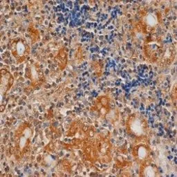 Anti-TSH receptor antibody [4C1] used in IHC (Paraffin sections) (IHC-P). GTX47974