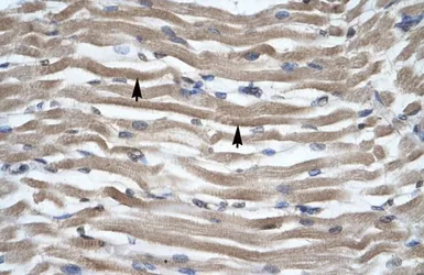 Anti-DLX2 antibody, N-term used in IHC (Paraffin sections) (IHC-P). GTX48461