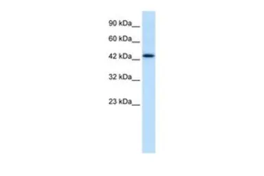 Anti-DLX2 antibody, N-term used in Western Blot (WB). GTX48461