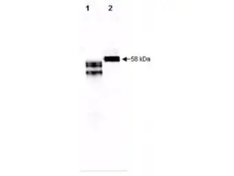 Anti-Fetuin A antibody used in Western Blot (WB). GTX48479