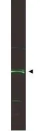 Anti-ING5 antibody used in Western Blot (WB). GTX48484