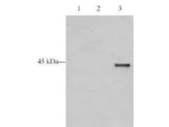 Anti-ING5 antibody used in Western Blot (WB). GTX48484
