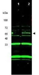 Anti-ING3 antibody used in Western Blot (WB). GTX48488