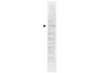 Anti-POLK antibody used in Western Blot (WB). GTX48495
