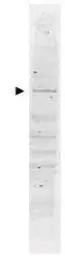 Anti-POLK antibody used in Western Blot (WB). GTX48495