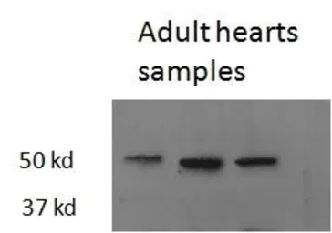 Anti-Thrb antibody, Internal used in Western Blot (WB). GTX48511