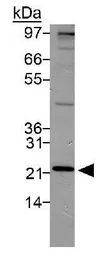 Anti-PSMD10 antibody used in Western Blot (WB). GTX48519