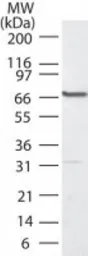 Anti-PLK1 antibody used in Western Blot (WB). GTX48549