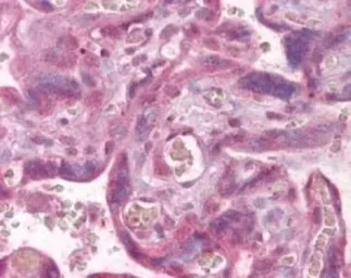 Anti-PLK1 antibody used in IHC (Paraffin sections) (IHC-P). GTX48549