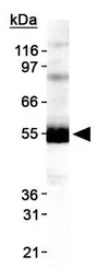 Anti-DGAT1 antibody used in Western Blot (WB). GTX48577