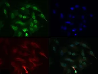 Anti-DGAT1 antibody used in Immunocytochemistry/ Immunofluorescence (ICC/IF). GTX48577