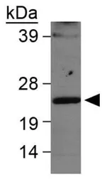 Anti-LMO2 antibody used in Western Blot (WB). GTX48597