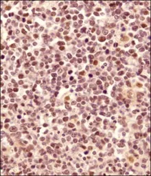 Anti-LMO2 antibody used in IHC (Paraffin sections) (IHC-P). GTX48597