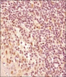 Anti-LMO2 antibody used in IHC (Paraffin sections) (IHC-P). GTX48597
