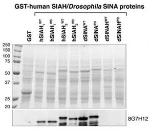 Anti-SIAH1/2 antibody [8G7H12] used in Western Blot (WB). GTX48599