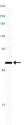 Anti-MAT1A + MAT2A antibody used in Western Blot (WB). GTX48600