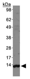 Anti-LC3A antibody used in Western Blot (WB). GTX48634