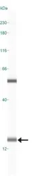 Anti-LC3A antibody used in Western Blot (WB). GTX48634
