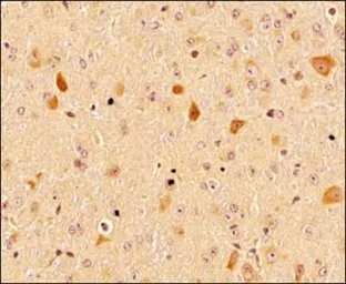 Anti-LC3A antibody used in IHC (Paraffin sections) (IHC-P). GTX48634