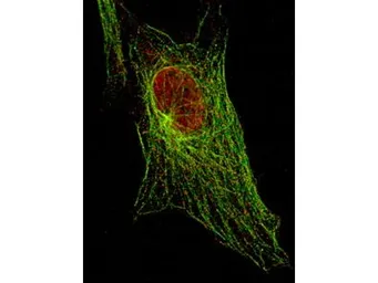 Anti-STAT5A (phospho Tyr694) antibody [5F6.F1] used in Immunocytochemistry/ Immunofluorescence (ICC/IF). GTX48648