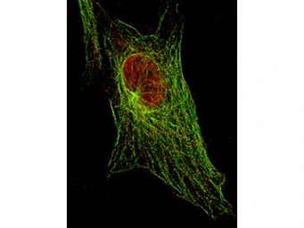 Anti-STAT5A (phospho Tyr694) antibody [5F6.F1] used in Immunocytochemistry/ Immunofluorescence (ICC/IF). GTX48648