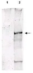 Anti-ATM (phospho Ser1981) antibody used in Western Blot (WB). GTX48650