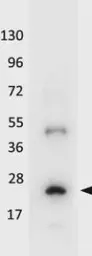 Anti-IL32A antibody (Biotin) used in Western Blot (WB). GTX48653