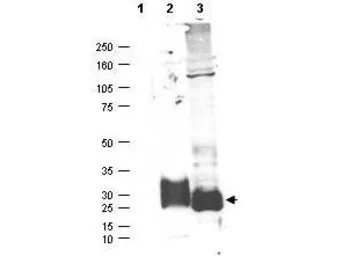 Anti-MFAP5 antibody used in Western Blot (WB). GTX48656