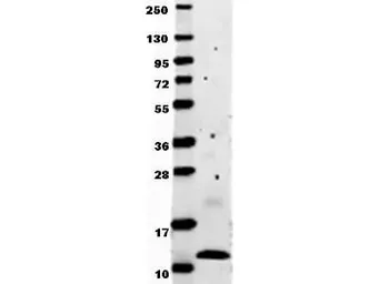 Anti-MCP1 / CCL2 antibody used in Western Blot (WB). GTX48661