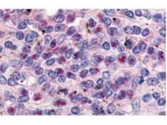 Anti-Cyclin L1 (Isoform 1) antibody used in IHC (Paraffin sections) (IHC-P). GTX48663