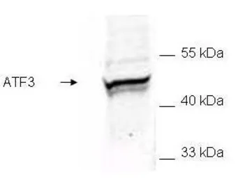 Anti-ATF3 antibody used in Western Blot (WB). GTX48669