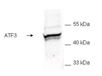 Anti-ATF3 antibody used in Western Blot (WB). GTX48669