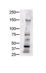 Anti-Jagged 1 antibody used in Western Blot (WB). GTX48691