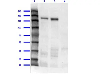 Anti-Jagged 1 antibody used in Western Blot (WB). GTX48691