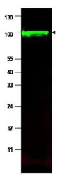 Anti-Iaspp antibody used in Western Blot (WB). GTX48696
