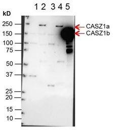 Anti-Casz1 antibody used in Western Blot (WB). GTX48704