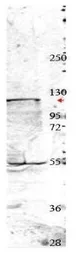 Anti-NEDD4 antibody used in Western Blot (WB). GTX48706