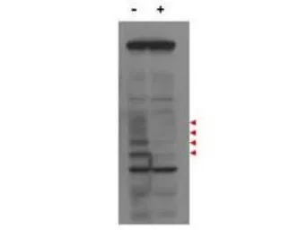 Anti-Mlf1 Interacting Protein antibody used in Western Blot (WB). GTX48709