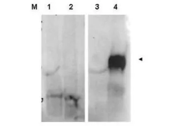 Anti-FAP antibody used in Western Blot (WB). GTX48711