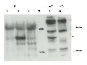 Anti-PSCDBP antibody used in Western Blot (WB). GTX48718